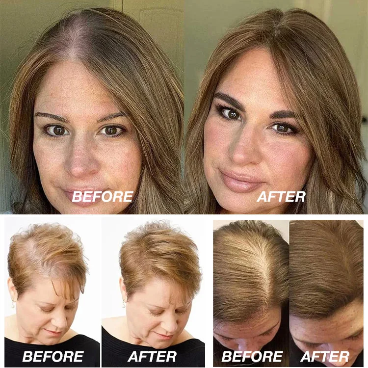 Christmas Sale- Buy 1 Take 1-stronger hair HAIR NOURISH SPRAY-Strengthen, Repair & Revitalize – Bring Your Hair Back to Li...