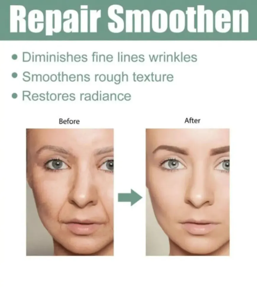 Eelhoe Collagen Boost Serum - Hijaluronska Kiselina - Protiv Bora