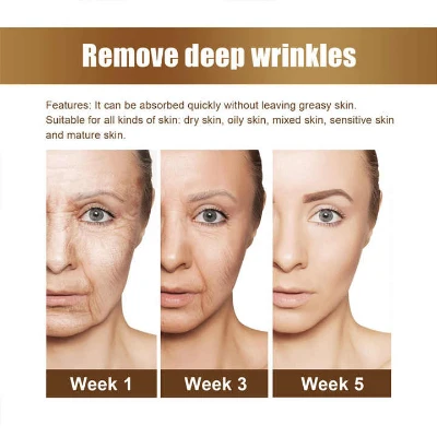 Kolagen Serum Protiv Bora za Zatezanje Koze