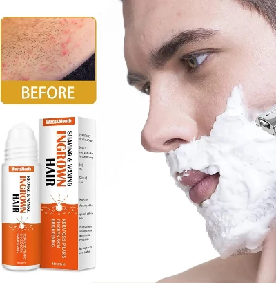 Roll-on Serum protiv Uraslih Dlaka