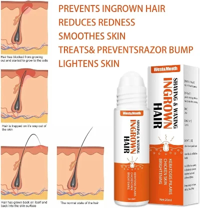 Roll-on Serum protiv Uraslih Dlaka
