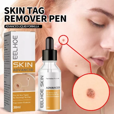 Serum za uklanjanje bradavica i tagova na kozi