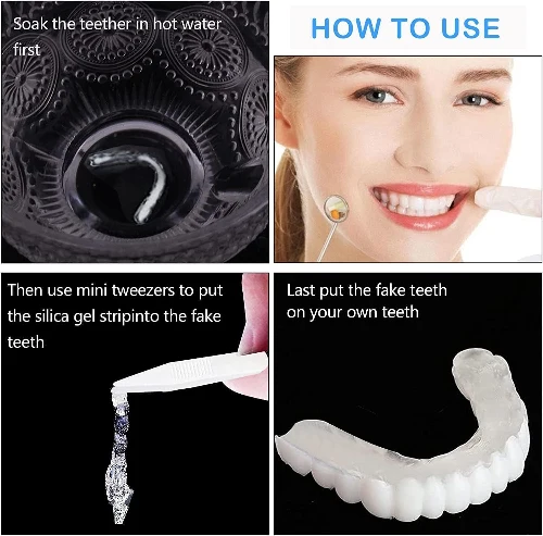 Snap On Smile - Osmeh za Tren