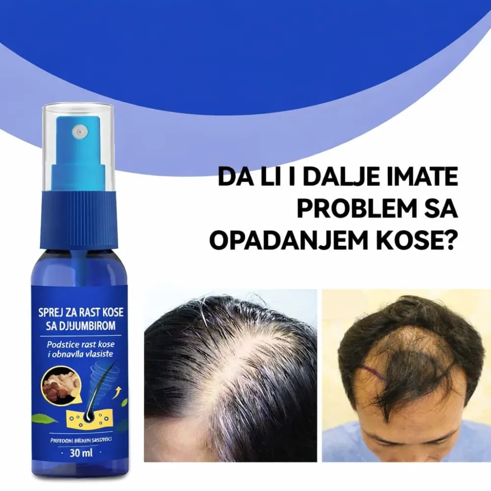 Sprej za rast kose sa đumbirom – protiv opadanja kose i obnavljanje vlasišta