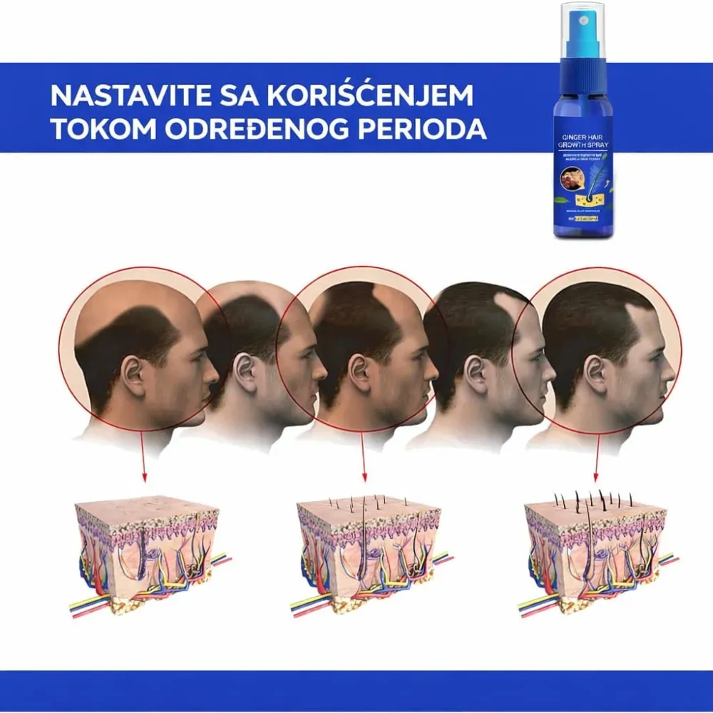 Sprej za rast kose sa đumbirom – protiv opadanja kose i obnavljanje vlasišta