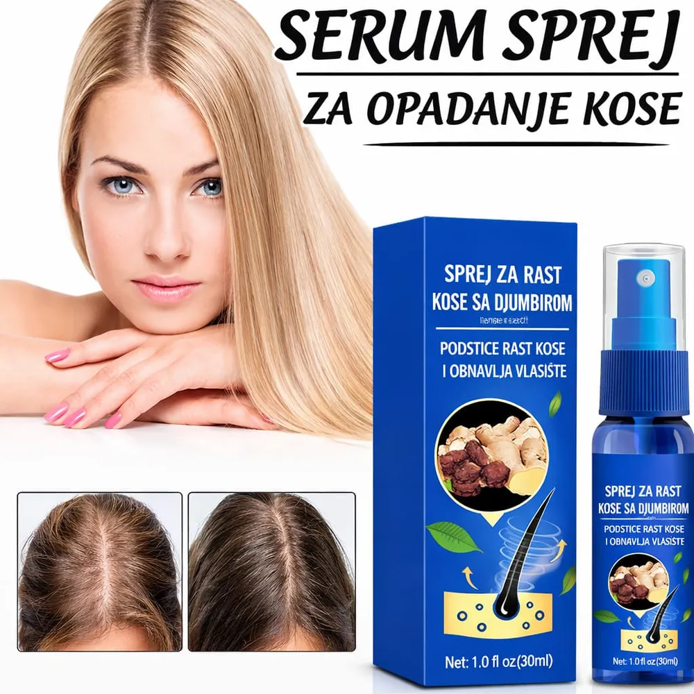 Sprej za rast kose sa đumbirom – protiv opadanja kose i obnavljanje vlasišta