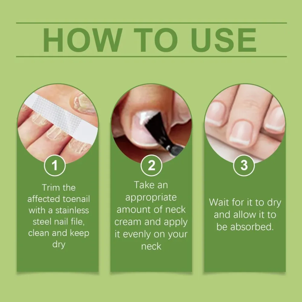 Tecnost Protiv Gljivica Na Noktima